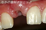 手術直前